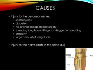 CAUSES 
• Injury to the peroneal nerve. 
• sports injuries 
• diabetes 
• hip or knee replacement surgery 
• spending long hours sitting cross-legged or squatting 
• childbirth 
• large amount of weight loss 
• Injury to the nerve roots in the spine (L5) 
 