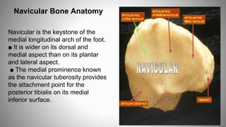 Lateral Navicular FOOT FRACTURE.pptx