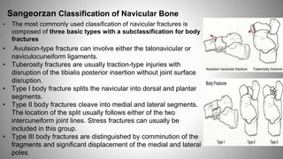 FOOT FRACTURE.pptx