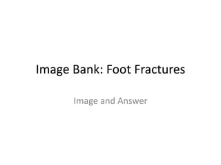 Image Bank: Foot Fractures Image and Answer 
