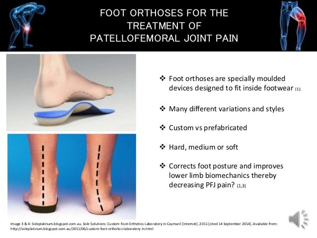 insoles for patellofemoral pain syndrome