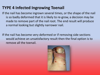 Fungal Nail Infection
• Fungal infection of nails is common. The infection causes
thickened and unsightly nails which some...