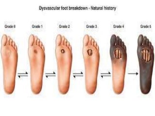 Foot problem | PPTX