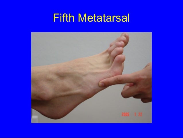 Styloid Process Foot Styloid Process Foot