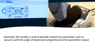 Generally, the treadle is used to provide control of a parameter, such as
vacuum, with the angle of depression proportional to the parameter output
 