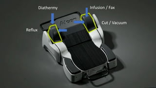 Infusion / Fax
Cut / Vacuum
Diathermy
Reflux
 