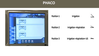 PHACO
 