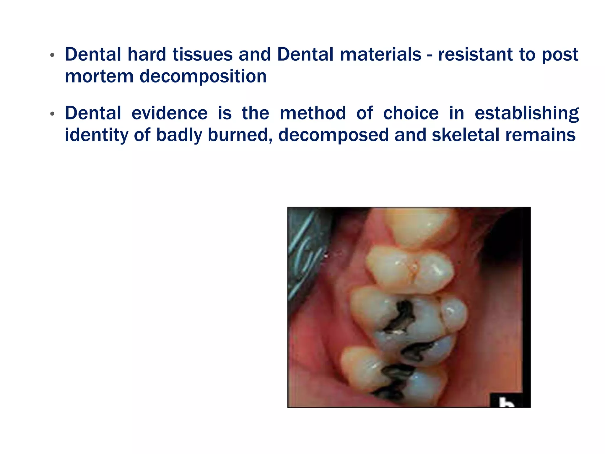 • Dental hard tissues and Dental materials - resistant to post
mortem decomposition
• Dental evidence is the method of choice in establishing
identity of badly burned, decomposed and skeletal remains
 