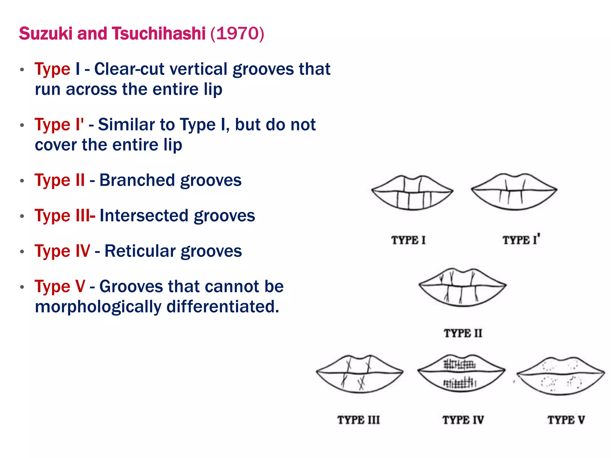 Suzuki and Tsuchihashi (1970)
• Type I - Clear-cut vertical grooves that
run across the entire lip
• Type I' - Similar to Type I, but do not
cover the entire lip
• Type II - Branched grooves
• Type III- Intersected grooves
• Type IV - Reticular grooves
• Type V - Grooves that cannot be
morphologically differentiated.
 
