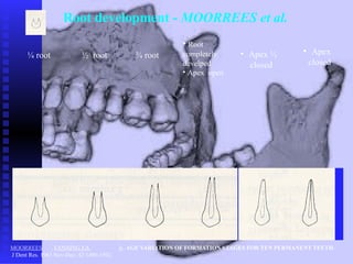 For-students-MECHANISM-OF-SECONDARY-DENTITION_Rozsa (1).pptx