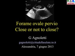 Forame ovale pervio
Close or not to close?
G Agnoletti
gagnoletti@cittadellasalute.to.it
Alessandria, 7 giugno 2013
 