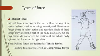 Types of force
Internal force:
Internal forces are forces that act within the object or
system whose motion in being investigated. Remember
forces come in pairs- action and reaction. Each of these
forces may affect the part of the body it acts on, but the
two forces do not affect the motion of the whole body
because the forces act in opposition.
Note: Pulling forces are referred as Tensile forces.
Pushing forces are referred as Compressive forces
 
