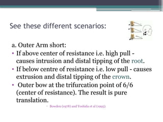 force-delivery-systems-Yasmin-Hzayyen.pptx