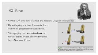 02 Force
◦ Newton’s 3rd law: Law of action and reaction. Usage in orthodontics
◦ The coil spring is activated by mesial force
to allow it’s placement on canine hook.
◦ After applying this activation force on
hook of canine we can observe two equal
forces Newton’s 3rd law .
Sir Isaac Newton1643-1727
 