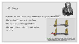 02 Force
◦ Newton’s 3rd law: Law of action and reaction. Usage in orthodontics
◦ The blue line(FA) is the activation force
◦ The red line(FD) is the opposite force
◦ The hook pulls the coil and the coil pushes
the hook.
Sir Isaac Newton1643-1727
 