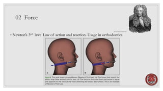02 Force
◦ Newton’s 3rd law: Law of action and reaction. Usage in orthodontics
Sir Isaac Newton1643-1727
 
