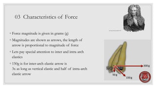 03 Characteristics of Force
◦ Force magnitude is given in grams (g)
◦ Magnitudes are shown as arrows, the length of
arrow is proportional to magnitude of force
◦ Lets pay special attention to inter and intra arch
elastics
◦ 150g is for inter-arch elastic arrow is
3x as long as vertical elastic and half of intra-arch
elastic arrow
Sir Isaac Newton1643-1727
 