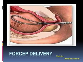FORCEP DELIVERY Made by:
Ramsha Marwat
 