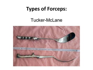 Types of Forceps:
 