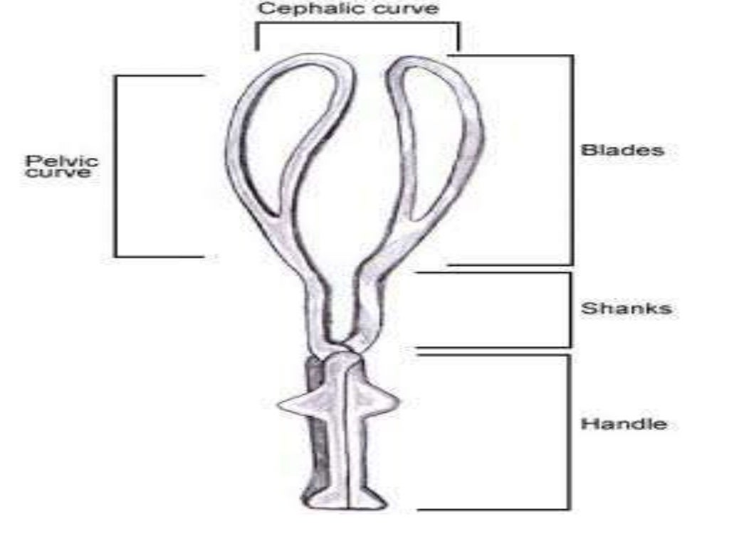 Forcep delivery