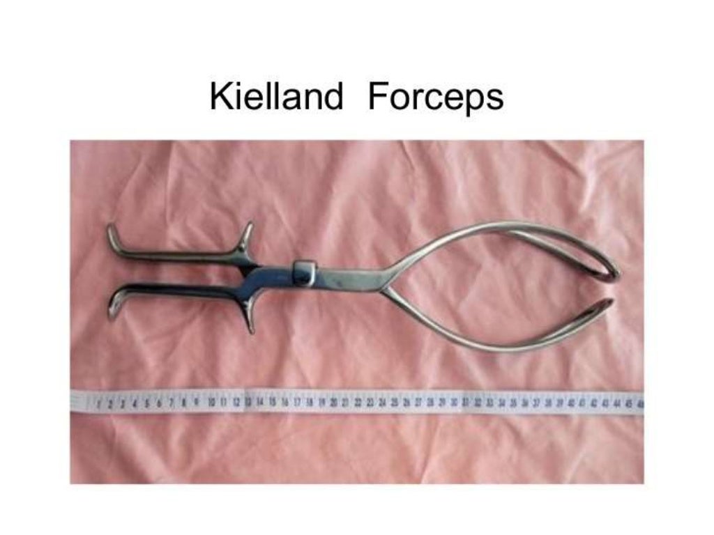 Forcep delivery