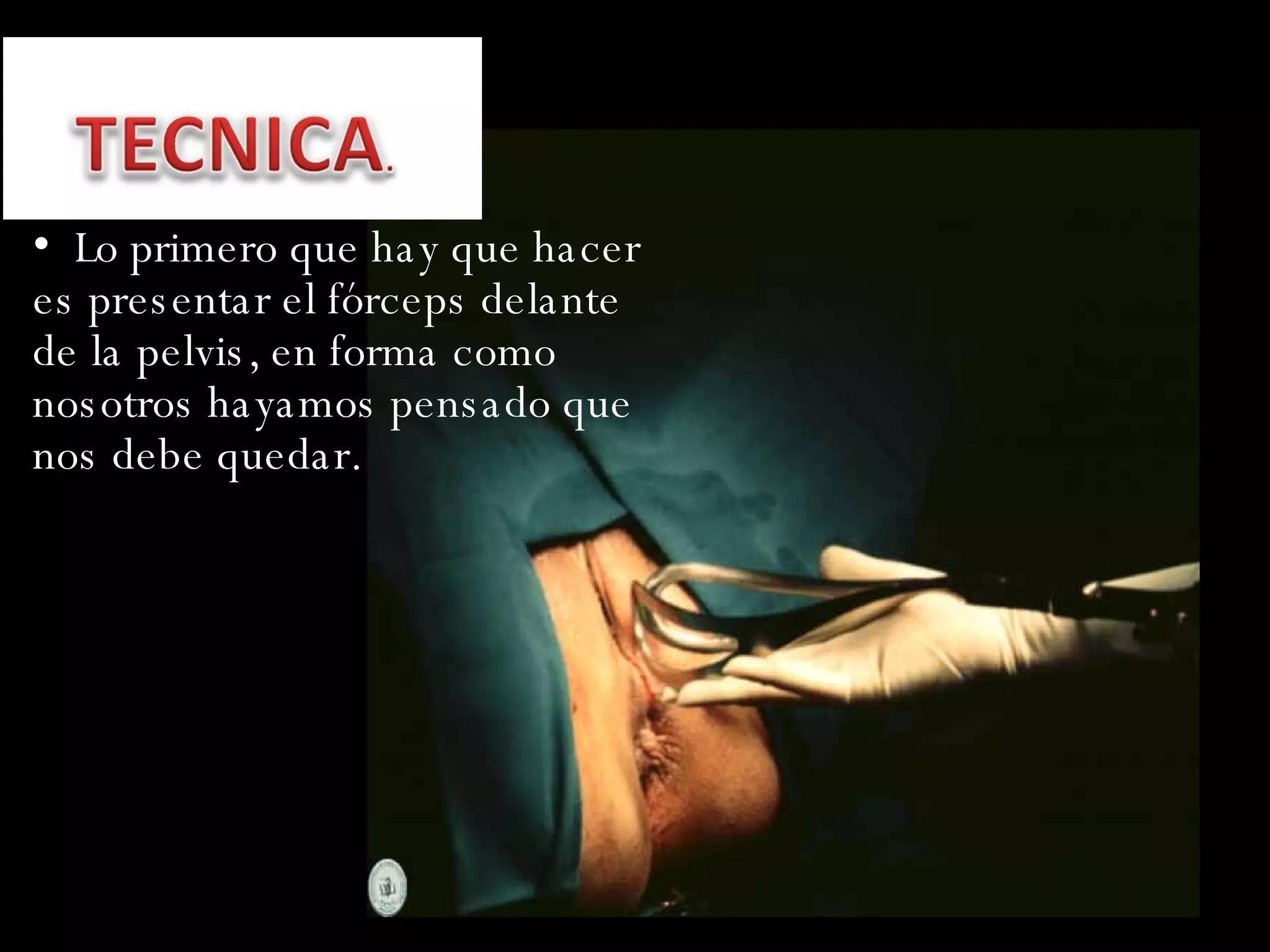 Lo primero que hay que hacer es presentar el fórceps delante de la pelvis, en forma como nosotros hayamos pensado que nos debe quedar. 