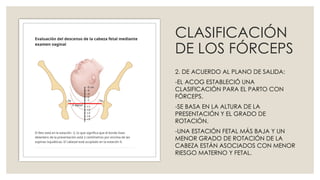 FÓRCEPS, tecnica, indicaciones y contras.pptx