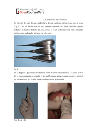 3. Elevador de hoja estrecha
En función del tipo de resto radicular o diente a extraer utilizaremos unos u otros
(Fig.1.), de tal forma que si por ejemplo tenemos un resto radicular grande
podemos utilizar un botador de hoja ancha, si es un resto radicular fino y estrecho
utilizaremos un botador de hoja estrecha, etc.
Fig 1
En la Figura 2 podemos observar la toma de estos instrumentos. El dedo índice
de la mano derecha acompaña el eje del botador, para obtener un mejor control
del instrumento y a la vez tener una función de protección.
Fig. 2. A y B
 