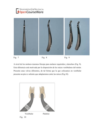 Fig. 7 Fig. 8 Fig. 9
A nivel de los molares tenemos fórceps para molares izquierdos y derechos (Fig. 9).
Esta diferencia está motivada por la disposición de las raíces vestibulares del molar.
Presenta unas valvas diferentes, de tal forma que la que colocamos en vestibular
presenta un pico o saliente que adaptaremos entre las raíces (Fig.10).
Vestibular Palatino
Fig. 10
 