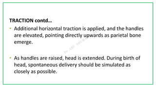 7C
TRACTION contd…
• Additional horizontal traction is applied, and the handles
are elevated, pointing directly upwards as parietal bone
emerge.
• As handles are raised, head is extended. During birth of
head, spontaneous delivery should be simulated as
closely as possible.
 