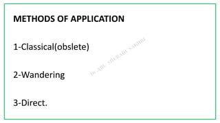 7C
METHODS OF APPLICATION
1-Classical(obslete)
2-Wandering
3-Direct.
 