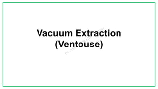 7C
Vacuum Extraction
(Ventouse)
 