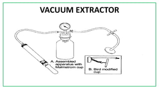 7C
VACUUM EXTRACTOR
 