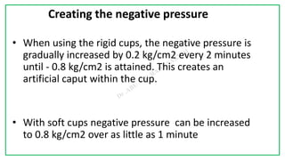 7C
Creating the negative pressure
• When using the rigid cups, the negative pressure is
gradually increased by 0.2 kg/cm2 every 2 minutes
until - 0.8 kg/cm2 is attained. This creates an
artificial caput within the cup.
• With soft cups negative pressure can be increased
to 0.8 kg/cm2 over as little as 1 minute
 