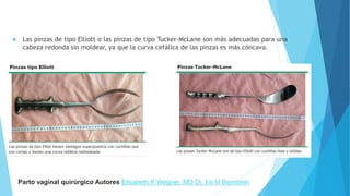  Las pinzas de tipo Elliott o las pinzas de tipo Tucker-McLane son más adecuadas para una
cabeza redonda sin moldear, ya que la curva cefálica de las pinzas es más cóncava.
Parto vaginal quirúrgico Autores Elisabeth K Wegner, MD Dr. Ira M Bernstein
 