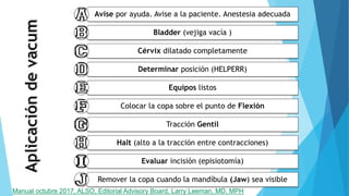 Avise por ayuda. Avise a la paciente. Anestesia adecuada
Bladder (vejiga vacía )
Cérvix dilatado completamente
Determinar posición (HELPERR)
Equipos listos
Colocar la copa sobre el punto de Flexión
Tracción Gentil
Halt (alto a la tracción entre contracciones)
Evaluar incisión (episiotomía)
Remover la copa cuando la mandíbula (Jaw) sea visible
Manual octubre 2017, ALSO, Editorial Advisory Board, Larry Leeman, MD, MPH
 
