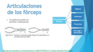  Los pedículos pueden ser
paralelos o sobrepuestos
Articulaciones
básicas
Inglesa
Alemana
Francesa
Noruega o
deslizable
Manual de maniobras y procedimientos en OBSTETRICIA, Dr. Carlos Armando Felix Baez
 