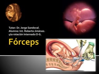 Tutor: Dr. Jorge Sandoval.
Alumno: Int. Roberto Jiménez.
4ta rotación Internado O-G.
 