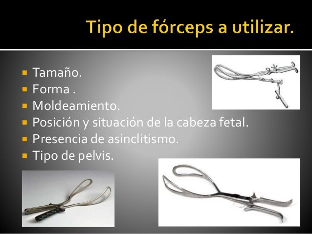 Forceps obstetricia