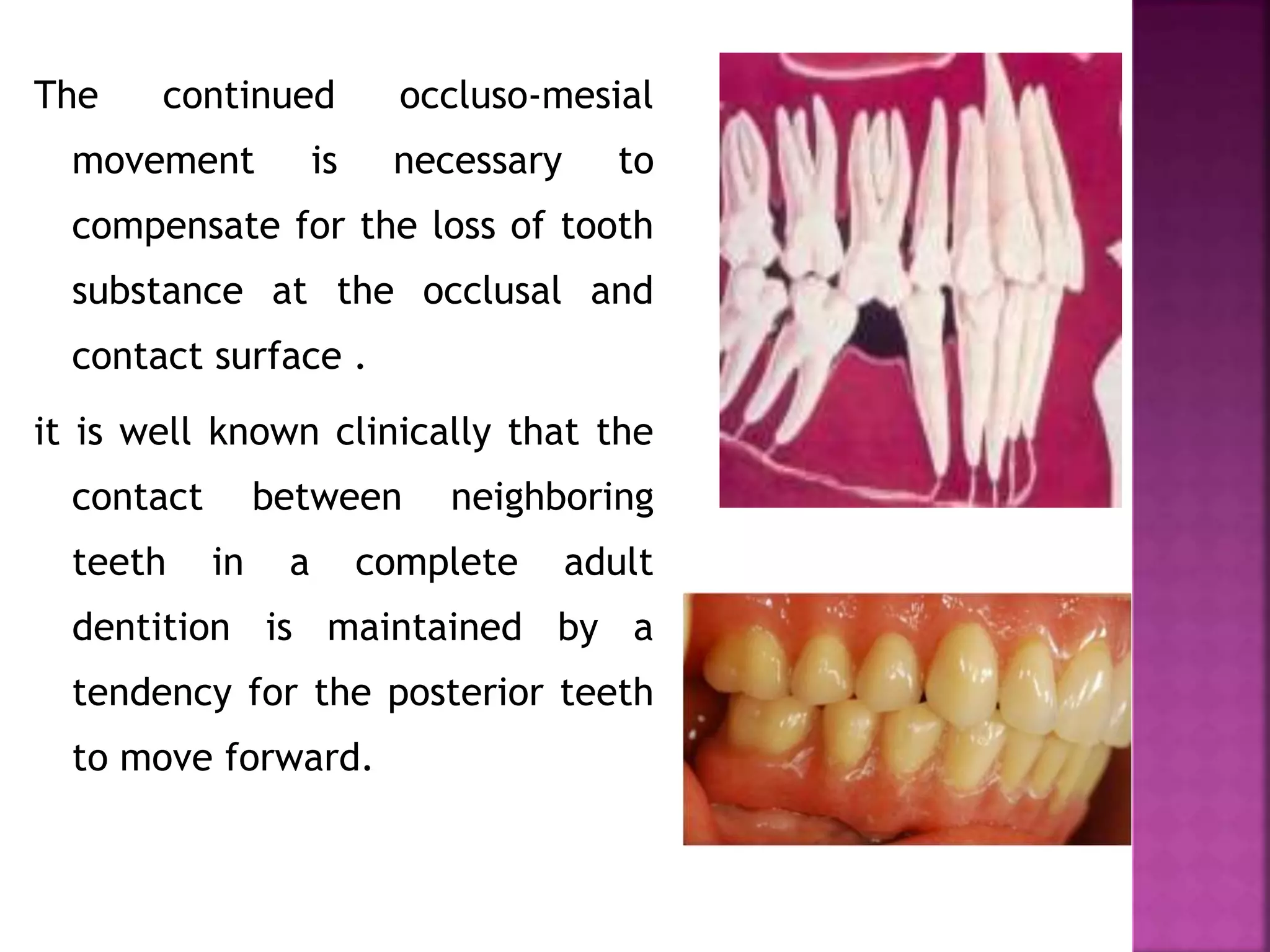 The continued occluso-mesial
movement is necessary to
compensate for the loss of tooth
substance at the occlusal and
contact surface .
it is well known clinically that the
contact between neighboring
teeth in a complete adult
dentition is maintained by a
tendency for the posterior teeth
to move forward.
 