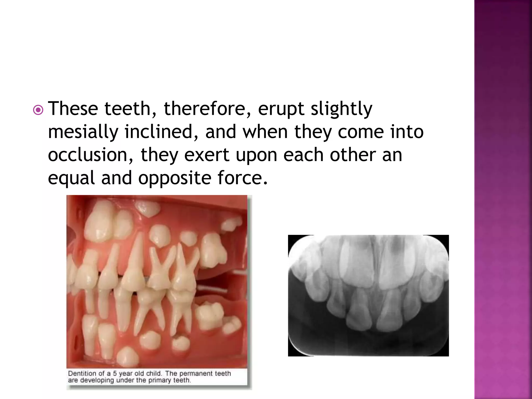  These teeth, therefore, erupt slightly
mesially inclined, and when they come into
occlusion, they exert upon each other an
equal and opposite force.
 