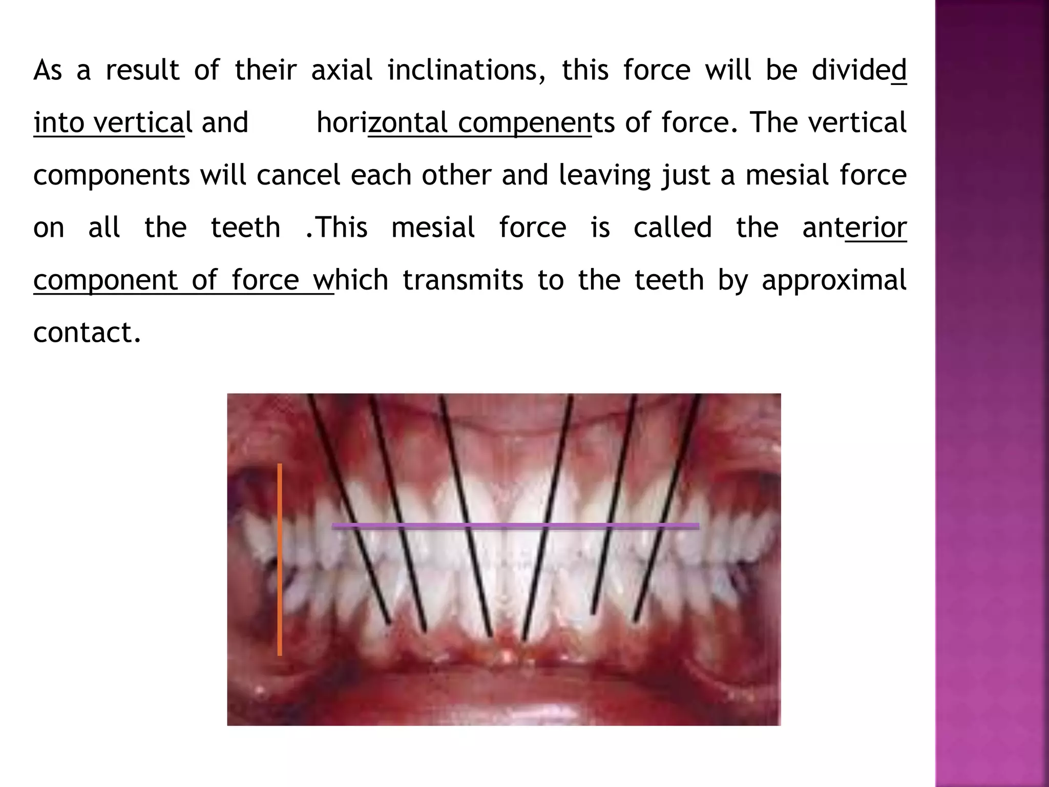As a result of their axial inclinations, this force will be divided
into vertical and horizontal compenents of force. The vertical
components will cancel each other and leaving just a mesial force
on all the teeth .This mesial force is called the anterior
component of force which transmits to the teeth by approximal
contact.
 