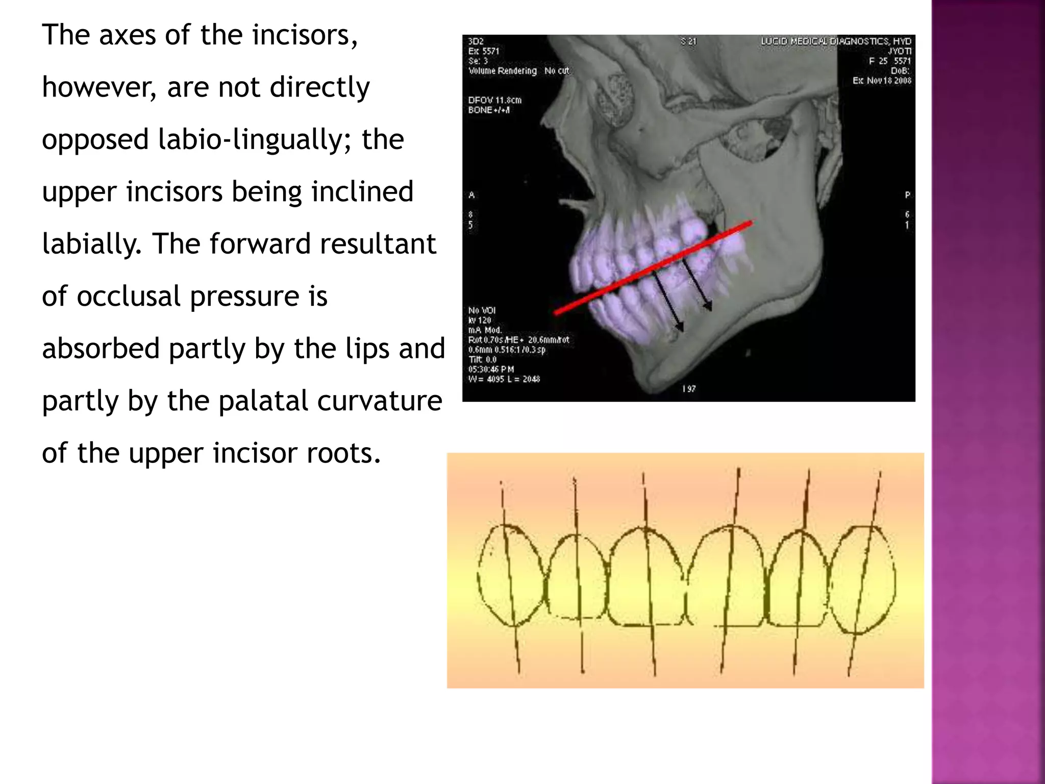 The axes of the incisors,
however, are not directly
opposed labio-lingually; the
upper incisors being inclined
labially. The forward resultant
of occlusal pressure is
absorbed partly by the lips and
partly by the palatal curvature
of the upper incisor roots.
 