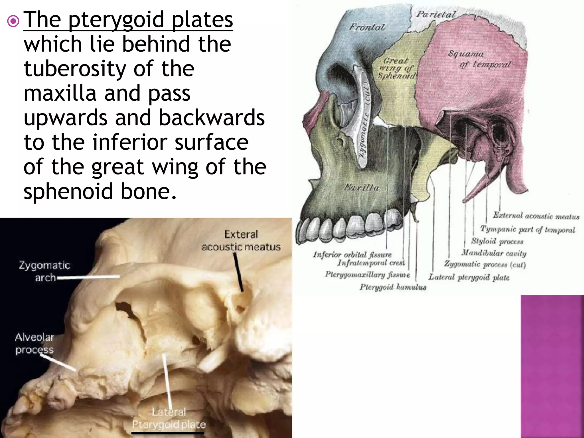  The pterygoid plates
which lie behind the
tuberosity of the
maxilla and pass
upwards and backwards
to the inferior surface
of the great wing of the
sphenoid bone.
 