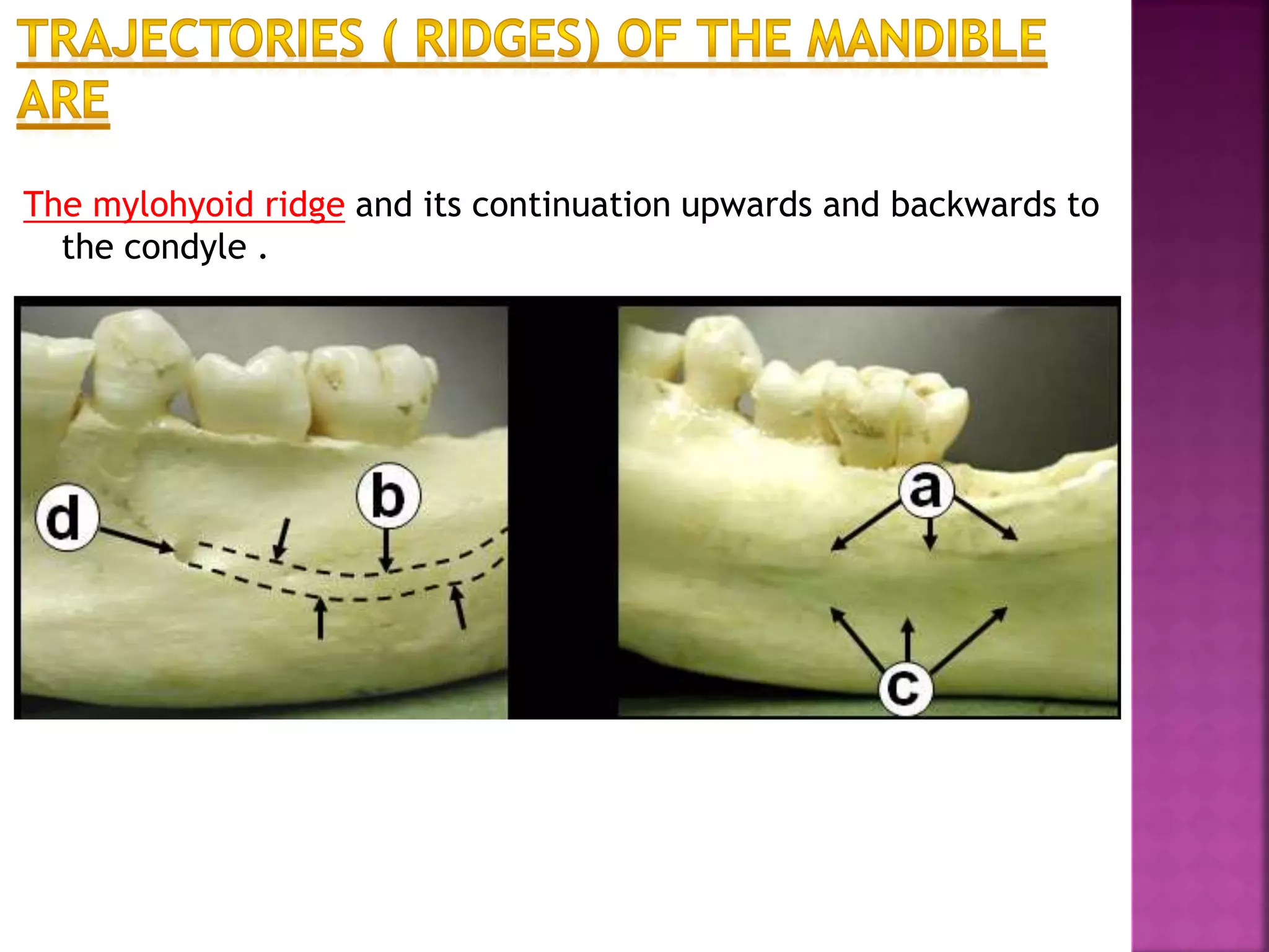 The mylohyoid ridge and its continuation upwards and backwards to
the condyle .
 