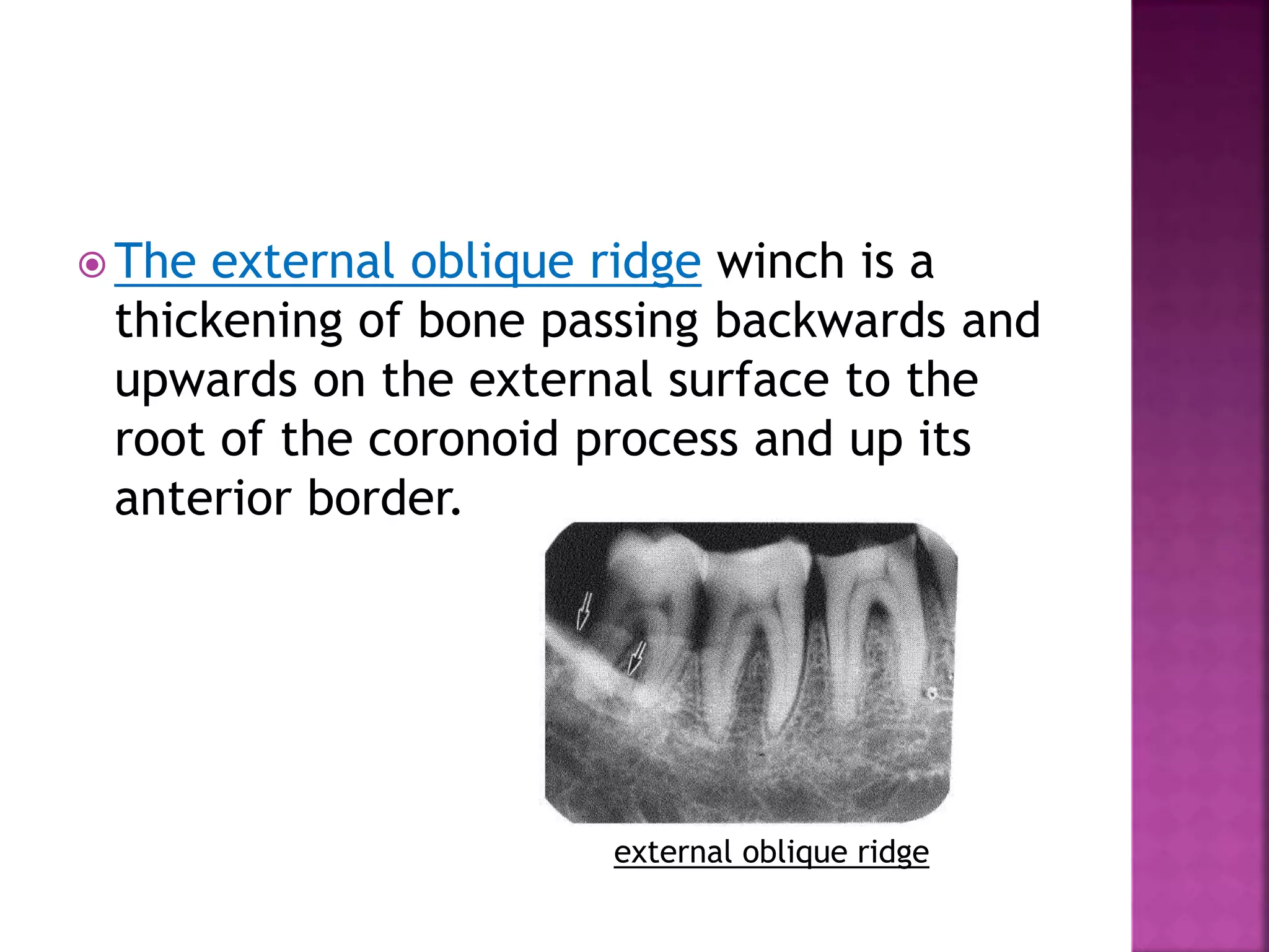  The external oblique ridge winch is a
thickening of bone passing backwards and
upwards on the external surface to the
root of the coronoid process and up its
anterior border.
external oblique ridge
 