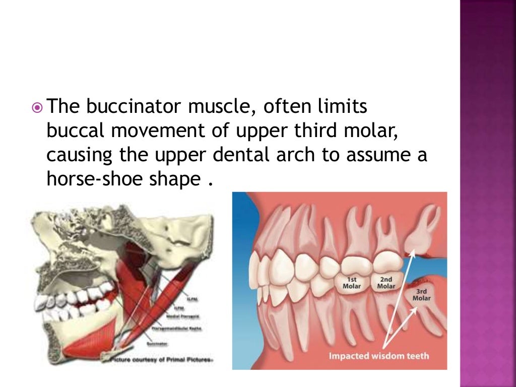 Forces of occlusion.ppt