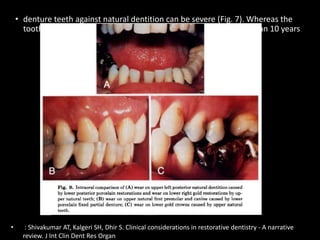 • denture teeth against natural dentition can be severe (Fig. 7). Whereas the
tooth structure loss opposing the complete denture took more than 10 years
• : Shivakumar AT, Kalgeri SH, Dhir S. Clinical considerations in restorative dentistry - A narrative
review. J Int Clin Dent Res Organ
 