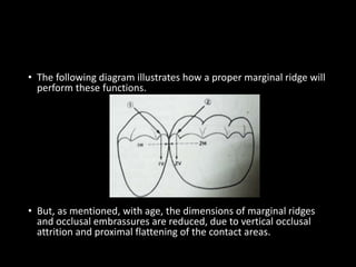 • The following diagram illustrates how a proper marginal ridge will
perform these functions.
• But, as mentioned, with age, the dimensions of marginal ridges
and occlusal embrassures are reduced, due to vertical occlusal
attrition and proximal flattening of the contact areas.
 