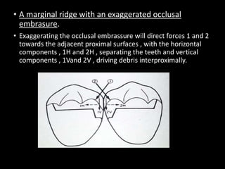 • A marginal ridge with an exaggerated occlusal
embrasure.
• Exaggerating the occlusal embrassure will direct forces 1 and 2
towards the adjacent proximal surfaces , with the horizontal
components , 1H and 2H , separating the teeth and vertical
components , 1Vand 2V , driving debris interproximally.
 